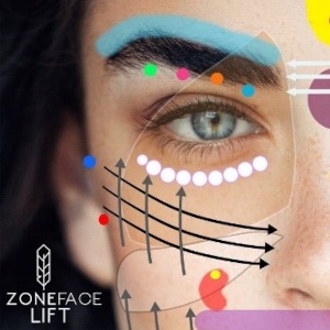 zone-facelift1