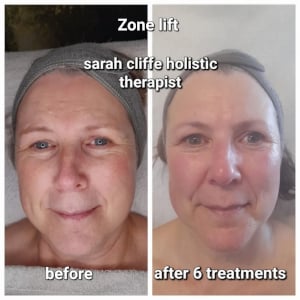 Zone lift - Lesley 1