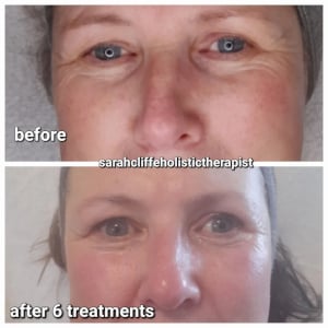 Zone lift - Lesley 4